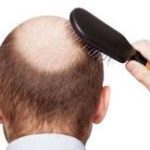 Hair loss treatment in Hindi बालों का झड़ना समस्या