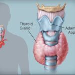 Thyroid Symptoms in Hindi