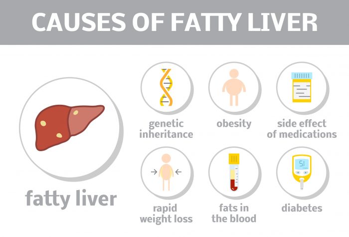 Fatty Liver Causes in Hindi